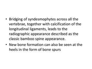 • Bridging of syndesmophytes across all the
vertebrae, together with calcification of the
longitudinal ligaments, leads to the
radiographic appearance described as the
classic bamboo spine appearance.
• New bone formation can also be seen at the
heels in the form of bone spurs
 