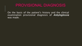 PROVISIONAL DIAGNOSIS
On the basis of the patient’s history and the clinical
examination provisional diagnosis of Ankyloglossia
was made.
