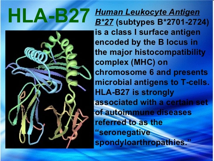 Ankylosing spondylitis