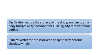 Ossification across the surface of the disc gives rise to small
bony bridges or syndesmophytes linking adjacent vertebral
bodies.
If many vertebrae are involved the spine may become
absolutely rigid.
 