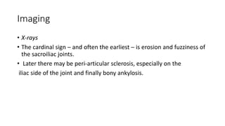Imaging
• X-rays
• The cardinal sign – and often the earliest – is erosion and fuzziness of
the sacroiliac joints.
• Later there may be peri-articular sclerosis, especially on the
iliac side of the joint and finally bony ankylosis.
 