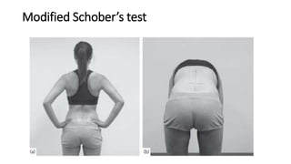 Modified Schober’s test
 