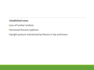 Established cases:
•Loss of lumbar lordosis
•Increased thoracic kyphosis
•Upright posture maintained by flexion in hip and knees
 