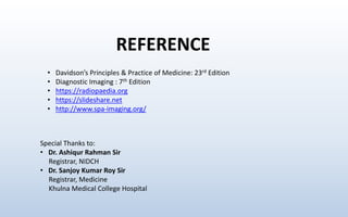 • Davidson’s Principles & Practice of Medicine: 23rd Edition
• Diagnostic Imaging : 7th Edition
• https://radiopaedia.org
• https://slideshare.net
• http://www.spa-imaging.org/
Special Thanks to:
• Dr. Ashiqur Rahman Sir
Registrar, NIDCH
• Dr. Sanjoy Kumar Roy Sir
Registrar, Medicine
Khulna Medical College Hospital
REFERENCE
 