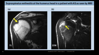 12 December 2020Ratankhuman (M.P.T., Ortho & Sports)21
 