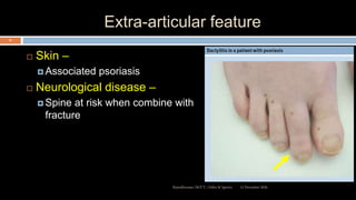 Extra-articular feature
 Skin –
 Associated psoriasis
 Neurological disease –
 Spine at risk when combine with
fracture
12 December 2020Ratankhuman (M.P.T., Ortho & Sports)
31
 