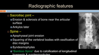 Radiographic features
 Sacroiliac joint –
 Erosion & sclerosis of bone near the articular
surface
 Ankylos later
 Spine –
 Apophyseal joint erosion
 Squaring of the vertebral bodies with ossification of
disc margins
 Syndesmophytes
 “Bamboo Spine” due to calcification of longitudinal12 December 2020Ratankhuman (M.P.T., Ortho & Sports)
35
 