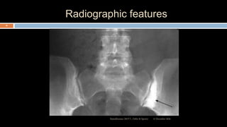 Radiographic features
12 December 2020Ratankhuman (M.P.T., Ortho & Sports)
36
 
