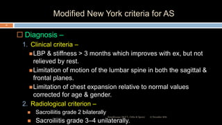 Modified New York criteria for AS
 Diagnosis –
1. Clinical criteria –
LBP & stiffness > 3 months which improves with ex, but not
relieved by rest.
Limitation of motion of the lumbar spine in both the sagittal &
frontal planes.
Limitation of chest expansion relative to normal values
corrected for age & gender.
2. Radiological criterion –
 Sacroiliitis grade 2 bilaterally
 Sacroiliitis grade 3–4 unilaterally.
12 December 2020Ratankhuman (M.P.T., Ortho & Sports)
43
 