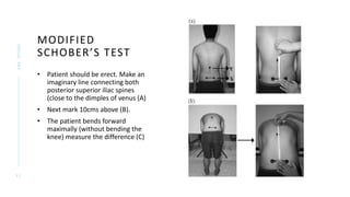 Ankylosing spondylitis.pptx