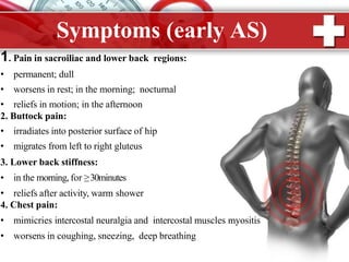 Ankylosing spondylitis by dr ashutosh