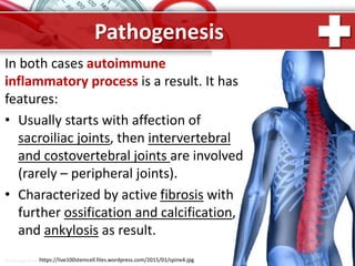ProPowerPoint.Ru
Pathogenesis
In both cases autoimmune
inflammatory process is a result. It has
features:
• Usually starts with affection of
sacroiliac joints, then intervertebral
and costovertebral joints are involved
(rarely – peripheral joints).
• Characterized by active fibrosis with
further ossification and calcification,
and ankylosis as result.
https://live100stemcell.files.wordpress.com/2015/01/spine4.jpg
 