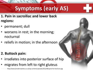 ProPowerPoint.Ru
Symptoms (early AS)
1. Pain in sacroiliac and lower back
regions:
• permanent; dull
• worsens in rest; in the morning;
nocturnal
• reliefs in motion; in the afternoon
2. Buttock pain:
• irradiates into posterior surface of hip
• migrates from left to right gluteus
http://www.ljmodernpilates.co.uk/wp-content/uploads/2012/08/spine-for-brochure.jpg
 