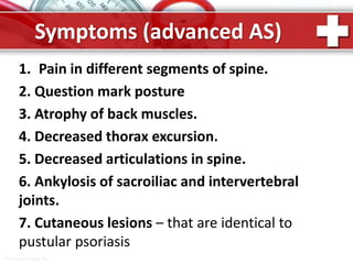 ProPowerPoint.Ru
Symptoms (advanced AS)
1. Pain in different segments of spine.
2. Question mark posture
3. Atrophy of back muscles.
4. Decreased thorax excursion.
5. Decreased articulations in spine.
6. Ankylosis of sacroiliac and intervertebral
joints.
7. Cutaneous lesions – that are identical to
pustular psoriasis
 