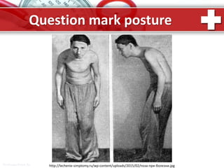 ProPowerPoint.Ru
Question mark posture
http://lechenie-simptomy.ru/wp-content/uploads/2015/02/поза-при-болезни.jpg
 