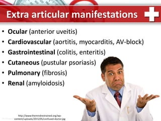 ProPowerPoint.Ru
Extra articular manifestations
• Ocular (anterior uveitis)
• Cardiovascular (aortitis, myocarditis, AV-block)
• Gastrointestinal (colitis, enteritis)
• Cutaneous (pustular psoriasis)
• Pulmonary (fibrosis)
• Renal (amyloidosis)
http://www.themindrestrained.org/wp-
content/uploads/2015/05/confused-doctor.jpg
 
