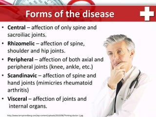 ProPowerPoint.Ru
Forms of the disease
• Central – affection of only spine and
sacroiliac joints.
• Rhizomelic – affection of spine,
shoulder and hip joints.
• Peripheral – affection of both axial and
peripheral joints (knee, ankle, etc.)
• Scandinavic – affection of spine and
hand joints (mimicries rheumatoid
arthritis)
• Visceral – affection of joints and
internal organs.
http://www.terryarondberg.com/wp-content/uploads/2010/08/Thinking-doctor-1.jpg
 