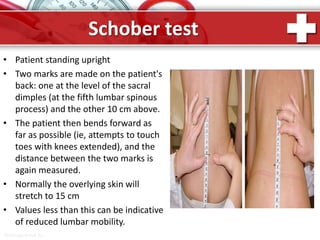 ProPowerPoint.Ru
Schober test
• Patient standing upright
• Two marks are made on the patient's
back: one at the level of the sacral
dimples (at the fifth lumbar spinous
process) and the other 10 cm above.
• The patient then bends forward as
far as possible (ie, attempts to touch
toes with knees extended), and the
distance between the two marks is
again measured.
• Normally the overlying skin will
stretch to 15 cm
• Values less than this can be indicative
of reduced lumbar mobility.
 