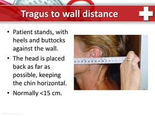 ProPowerPoint.Ru
Tragus to wall distance
• Patient stands, with
heels and buttocks
against the wall.
• The head is placed
back as far as
possible, keeping
the chin horizontal.
• Normally <15 cm.
 