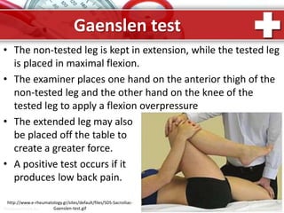 ProPowerPoint.Ru
Gaenslen test
• The non-tested leg is kept in extension, while the tested leg
is placed in maximal flexion.
• The examiner places one hand on the anterior thigh of the
non-tested leg and the other hand on the knee of the
tested leg to apply a flexion overpressure
• The extended leg may also
be placed off the table to
create a greater force.
• A positive test occurs if it
produces low back pain.
http://www.e-rheumatology.gr/sites/default/files/SDS-Sacroiliac-
Gaenslen-test.gif
 