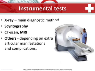 ProPowerPoint.Ru
Instrumental tests
• X-ray – main diagnostic method.
• Scyntygraphy
• CT-scan, MRI
• Others - depending on extra
articular manifestations
and complications.
http://www.medgadget.com/wp-content/uploads/2014/10/ct-scanner.png
 