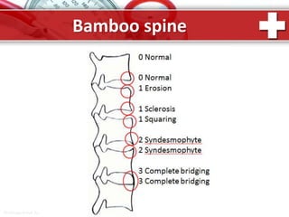 ProPowerPoint.Ru
Bamboo spine
 