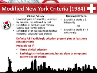 ProPowerPoint.Ru
Modified New York Criteria (1984)
Clinical Criteria
• Low back pain, > 3 months, improved
by exercise, not relieved by rest
• Limitation of lumbar spine motion,
sagittal and frontal planes
• Limitation of chest expansion relative
to normal values for age and sex
Radiologic Criteria
• Sacroiliitis grade  2
bilaterally
OR
• Sacroiliitis grade 3 – 4
unilaterally
Definite AS if radiologic criterion present plus at least one
clinical criteria
Probable AS if:
• Three clinical criterion
• Radiologic criterion present, but no signs or symptoms
satisfy clinical criteria
 