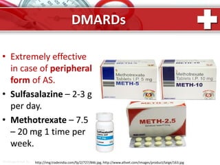 ProPowerPoint.Ru
DMARDs
• Extremely effective
in case of peripheral
form of AS.
• Sulfasalazine – 2-3 g
per day.
• Methotrexate – 7.5
– 20 mg 1 time per
week.
http://img.tradeindia.com/fp/2/727/846.jpg, http://www.allivet.com/images/product/large/163.jpg
 