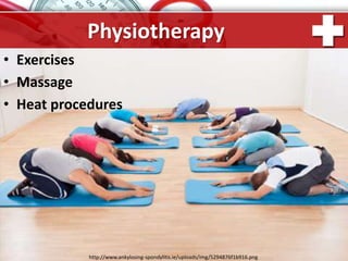 ProPowerPoint.Ru
Physiotherapy
• Exercises
• Massage
• Heat procedures
http://www.ankylosing-spondylitis.ie/uploads/img/5294876f1b916.png
 