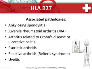 ProPowerPoint.Ru
HLA B27
Associated pathologies:
• Ankylosing spondylitis
• Juvenile rheumatoid arthritis (JRA)
• Arthritis related to Crohn's disease or
ulcerative colitis
• Psoriatic arthritis
• Reactive arthritis (Reiter's syndrome)
• Uveitis
http://photos.gograph.com/thumbs/CSP/CSP992/k13474673.jpg
 