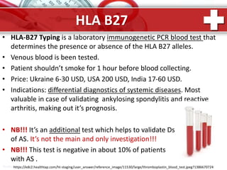 ProPowerPoint.Ru
HLA B27
• HLA-B27 Typing is a laboratory immunogenetic PCR blood test that
determines the presence or absence of the HLA B27 alleles.
• Venous blood is been tested.
• Patient shouldn’t smoke for 1 hour before blood collecting.
• Price: Ukraine 6-30 USD, USA 200 USD, India 17-60 USD.
• Indications: differential diagnostics of systemic diseases. Most
valuable in case of validating ankylosing spondylitis and reactive
arthritis, making out it’s prognosis.
• NB!!! It’s an additional test which helps to validate Ds
of AS. It’s not the main and only investigation!!!
• NB!!! This test is negative in about 10% of patients
with AS .
https://edc2.healthtap.com/ht-staging/user_answer/reference_image/11530/large/thromboplastin_blood_test.jpeg?1386670724
 