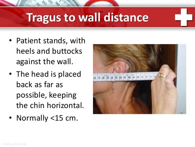 Occiput To Wall Distance Test