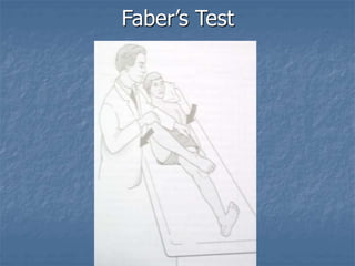 Faber’s Test
 