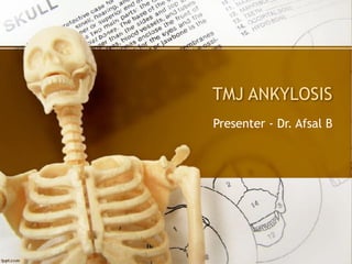 TMJ ANKYLOSIS
Presenter - Dr. Afsal B
 