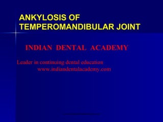 ANKYLOSIS OF
TEMPEROMANDIBULAR JOINT
INDIAN DENTAL ACADEMY
Leader in continuing dental education
www.indiandentalacademy.com

www.indiandentalacademy.com

 