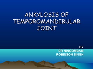ANKYLOSIS OFANKYLOSIS OF
TEMPOROMANDIBULARTEMPOROMANDIBULAR
JOINTJOINT
BY
DR NINGOMBAM
ROBINSON SINGH
 