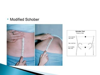  Modified Schober
 