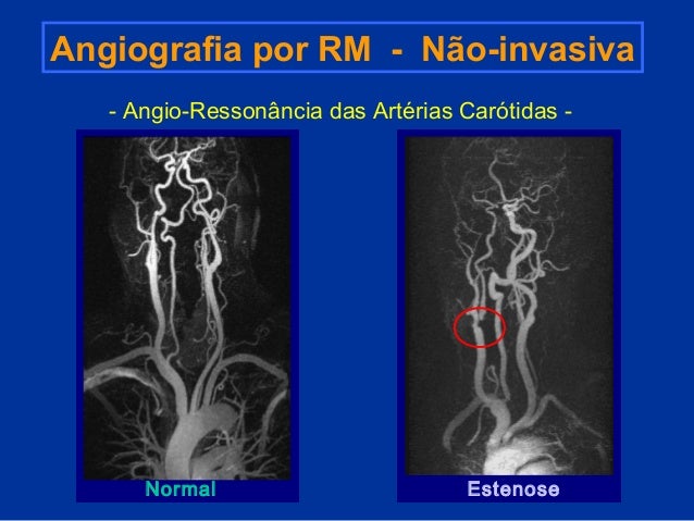 Exame das carotidas