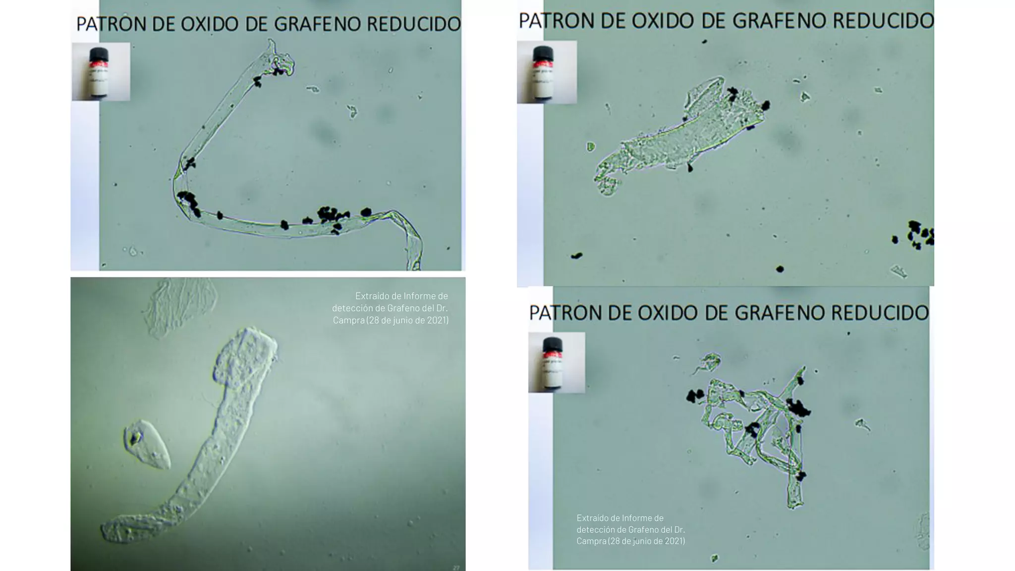 Extraído de Informe de
detección de Grafeno del Dr.
Campra (28 de junio de 2021)
Extraído de Informe de
detección de Grafeno del Dr.
Campra (28 de junio de 2021)
 
