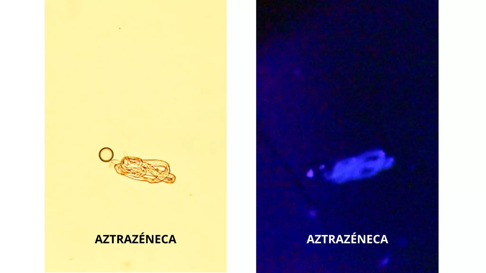 AZTRAZÉNECA AZTRAZÉNECA
 