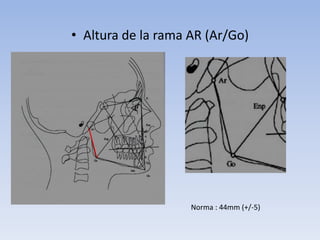 • Altura de la rama AR (Ar/Go)
Norma : 44mm (+/-5)
 