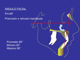 ANGULO FACIAL FH-NP Protrusión o retrusió mandibular Promedio 88° Mínimo 82° Máximo 95° 