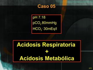 Caso 05 pH 7.18 pCO 2  80mmHg HCO 3 -  30mEq/l Acidosis Respiratoria  + Acidosis Metabólica 