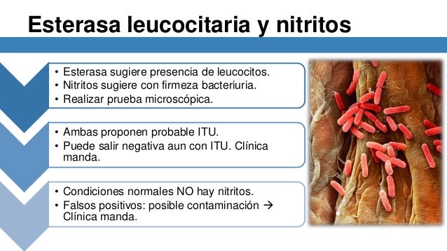 Análisis de laboratorio urológicos