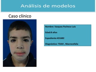 Caso clínico 
Nombre: Vazquez Pacheco Luis 
Edad:8 años 
Expediente:431682 
Diagnóstico: TDAH , Macrocefalia 
 