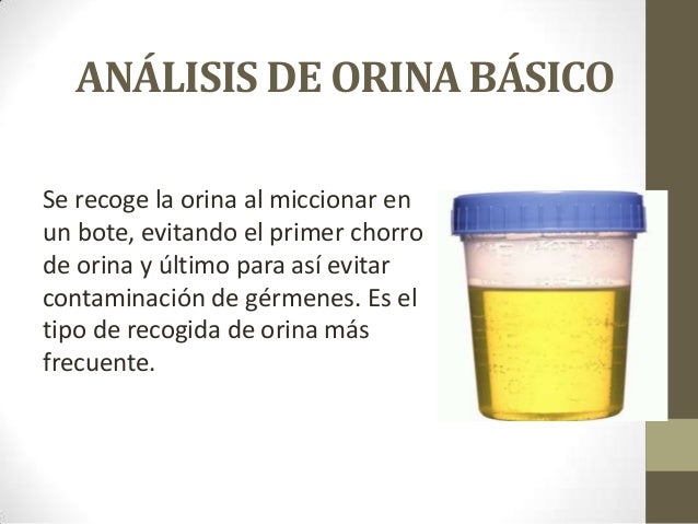 Análisis de orina Análisis de orina
