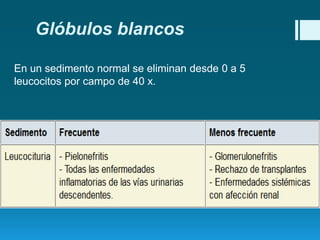 Glóbulos blancos
En un sedimento normal se eliminan desde 0 a 5
leucocitos por campo de 40 x.

 