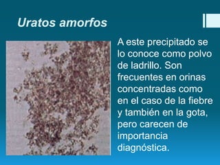 Uratos amorfos
A este precipitado se
lo conoce como polvo
de ladrillo. Son
frecuentes en orinas
concentradas como
en el caso de la fiebre
y también en la gota,
pero carecen de
importancia
diagnóstica.

 