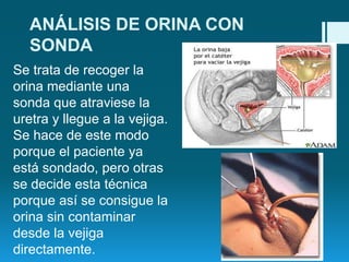 ANÁLISIS DE ORINA CON
SONDA
Se trata de recoger la
orina mediante una
sonda que atraviese la
uretra y llegue a la vejiga.
Se hace de este modo
porque el paciente ya
está sondado, pero otras
se decide esta técnica
porque así se consigue la
orina sin contaminar
desde la vejiga
directamente.

 