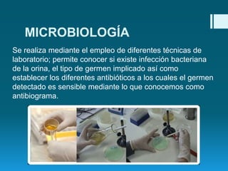 MICROBIOLOGÍA
Se realiza mediante el empleo de diferentes técnicas de
laboratorio; permite conocer si existe infección bacteriana
de la orina, el tipo de germen implicado así como
establecer los diferentes antibióticos a los cuales el germen
detectado es sensible mediante lo que conocemos como
antibiograma.

 